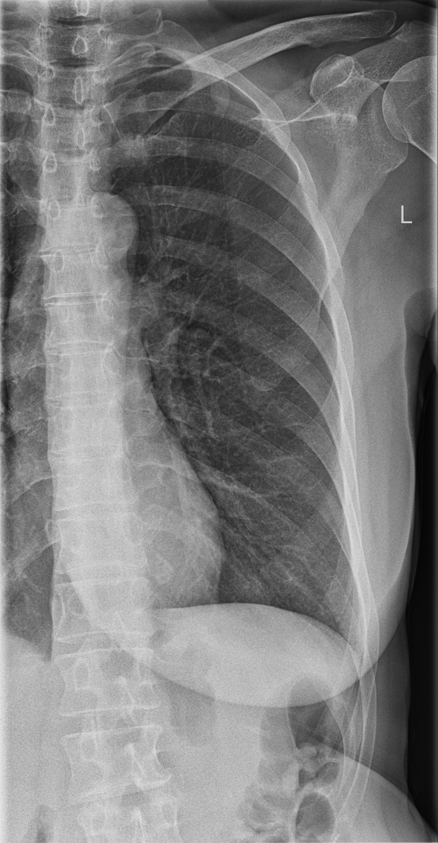 Thoraxbereich MTR | OrthoRad