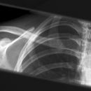 clavicula1.jpg