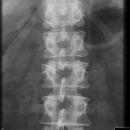 Deckplatte LWK 2 ohne Hinterkante